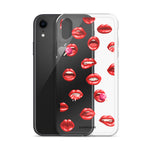 Lips | Clear iPhone Case